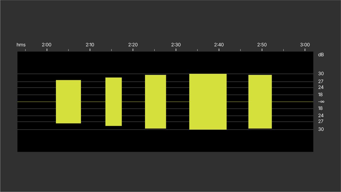 B: Waveform view with amplitude scale expanded. B: Waveform view with amplitude scale expanded.
